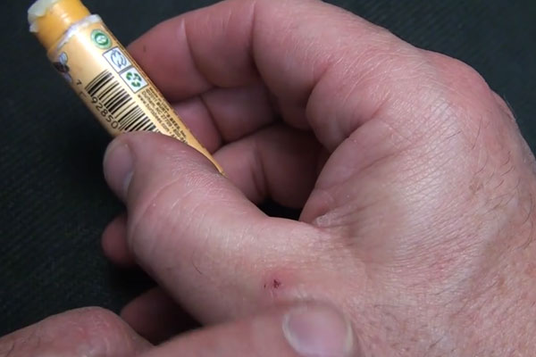 Human hand holding chapstick with small cut on thumb