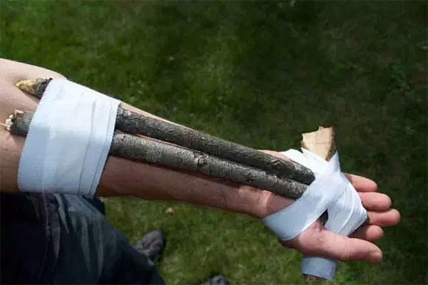 Person using an arm splint made with sticks and tape
