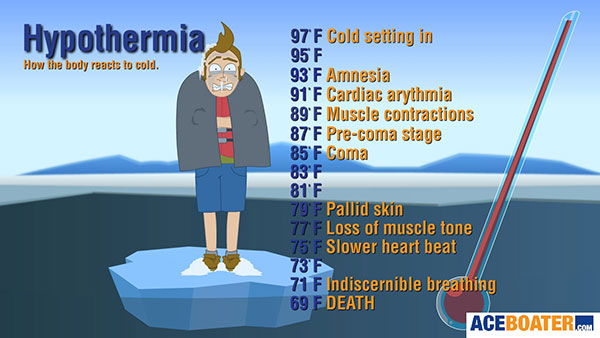 Hypothermia Chart